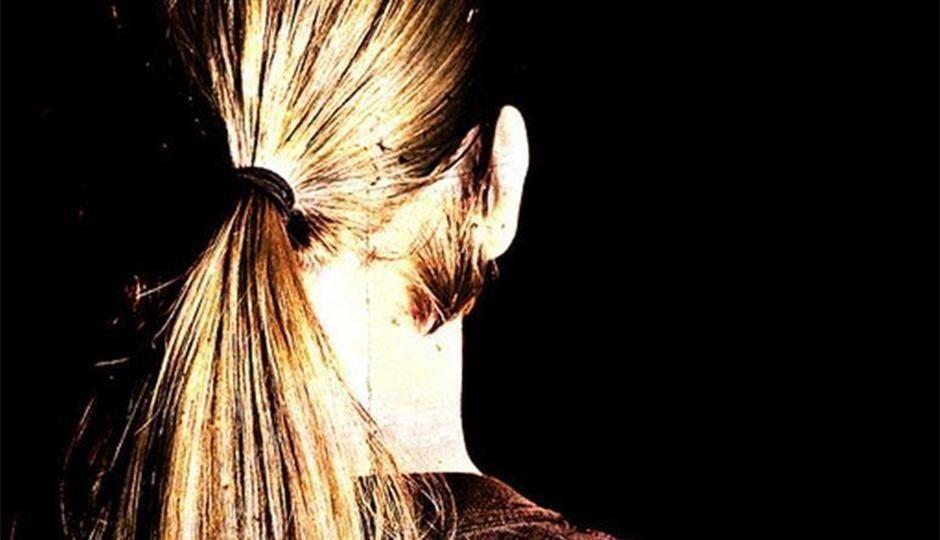 4 Causes of Women&#039;s Hair Loss