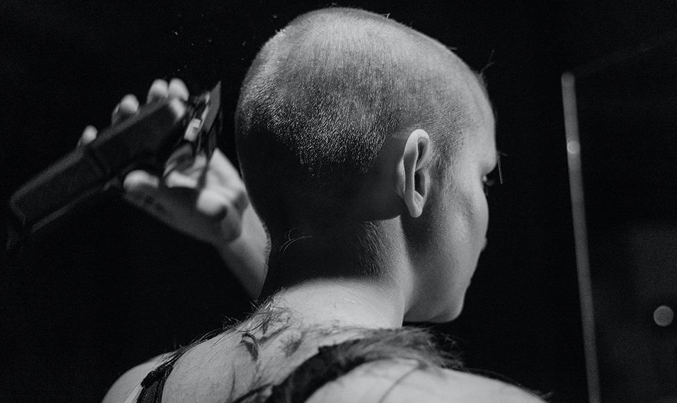 Is Shaving Your Head the Best Solution for Baldness?